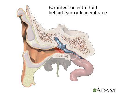 Indications