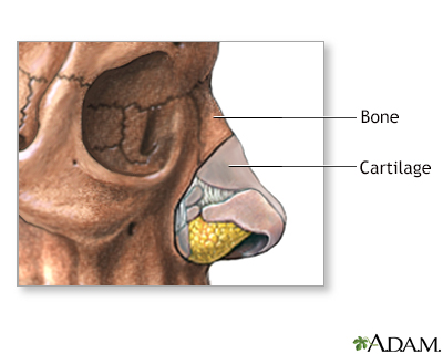 Nose surgery - series