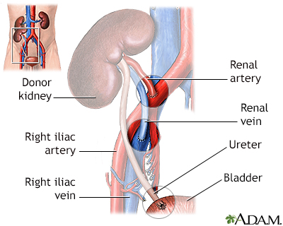 Procedure