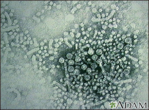 Hepatitis B virus