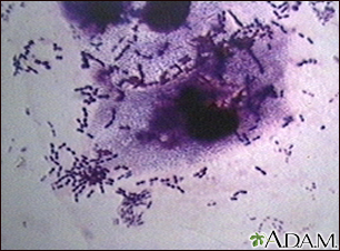 Pneumococci organism