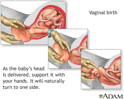 Childbirth