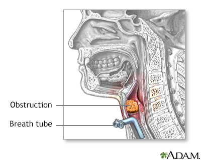 Procedure