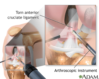 Procedure, part 2