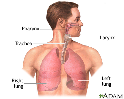 Lung transplant - series