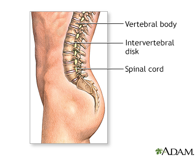 Spinal fusion - series - Normal anatomy