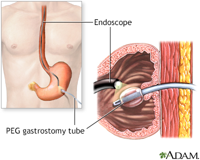 Procedure, part 2