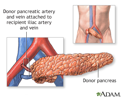 Procedure, part 2