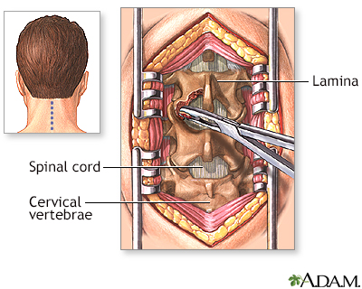 Procedure