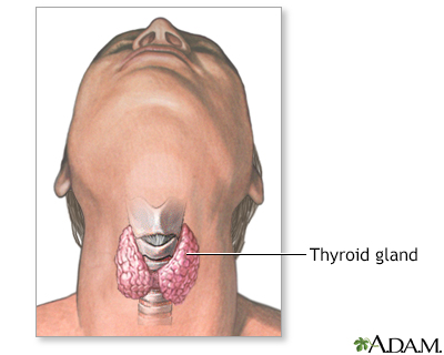 Thyroidectomy - Series