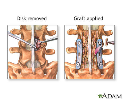 Procedure, part 2