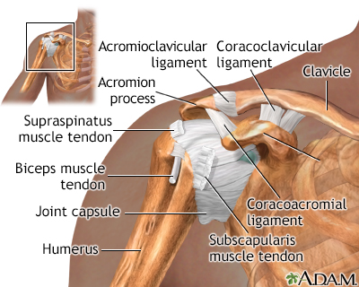 Shoulder separation - Series