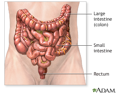 Colon cancer - series