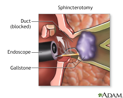 Procedure, part 2