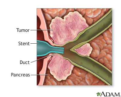 Procedure, part 3