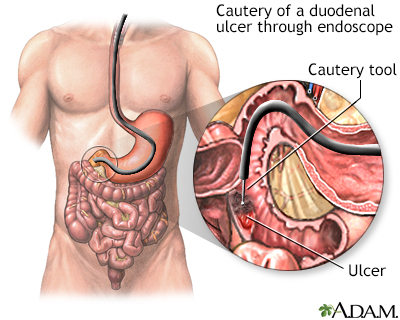 Procedure, part 2