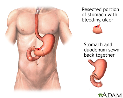 Procedure, part 3