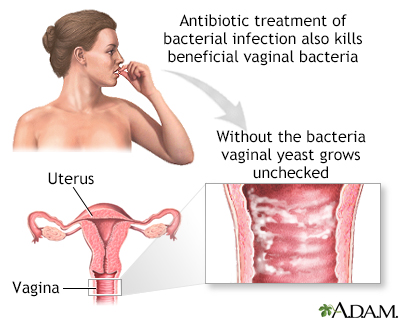 Secondary infection