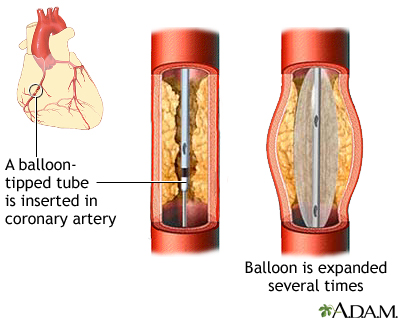 Procedure, part 3