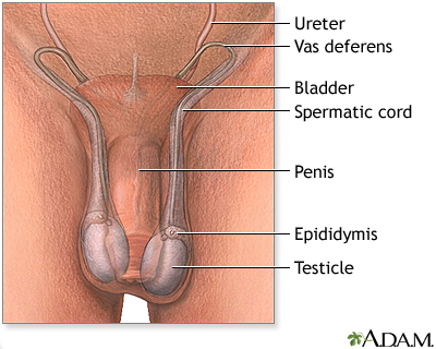 Testicular torsion repair - series