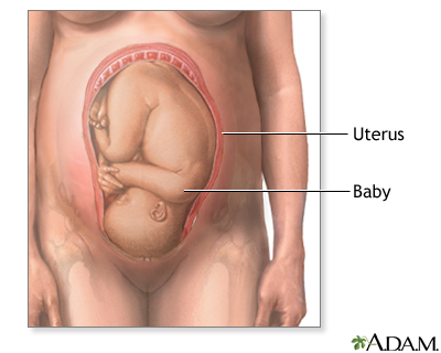 Breech - series