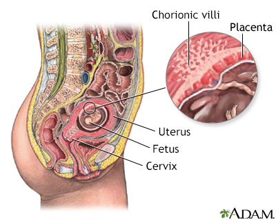 Chorionic villus sampling - normal anatomy