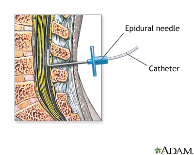 Procedure, part 4