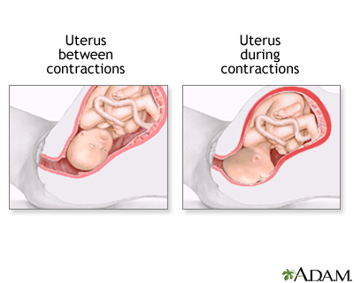 Procedure, part 2