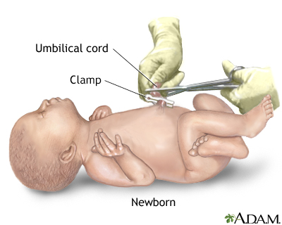 Procedure, part 6