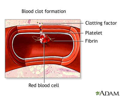 Blood clot formation