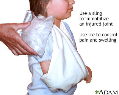 Triangular shoulder sling