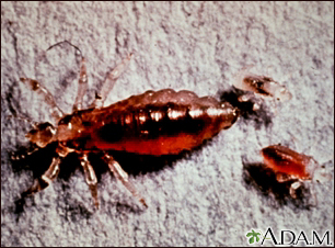 Body louse, female and larvae