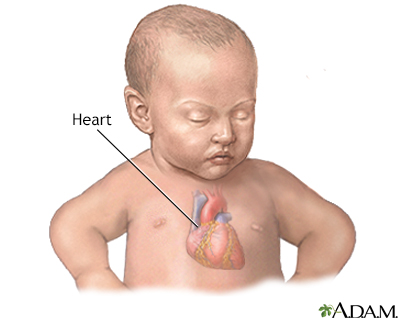 Patent ductus arteriosis (PDA) - series - Infant heart anatomy