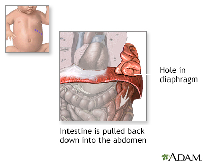 Procedure, part 1