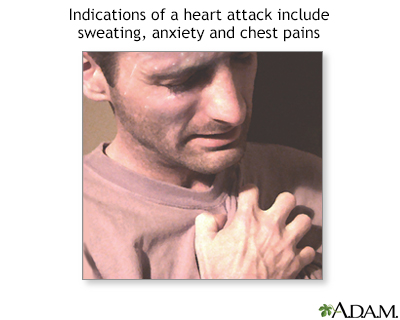 Symptoms of heart attack