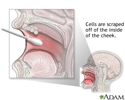 Buccal  smear - illustration