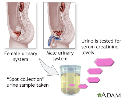 Creatinine urine test