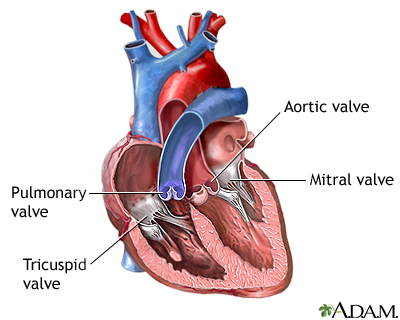 Heart valves