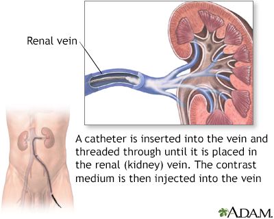 Renal veins