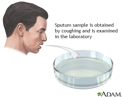 Sputum test