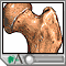 Osteoporosis