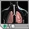 Cancer of the throat or larynx