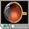 Macular degeneration