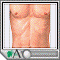 Stomach ulcer