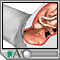Vaginal delivery