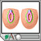 Sexual differentiation