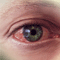 Let's talk about pink eye
