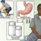 Using a multi-dimensional approach to treat diabetes
