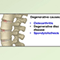 Common causes of low back pain