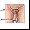 Male reproductive anatomy